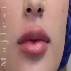 drgholamrezamajlesi2