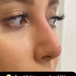drladannazemi3