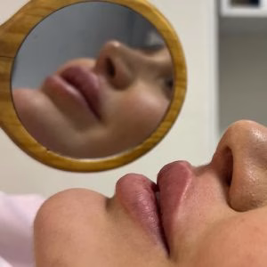 مرکز لیزر بانک، بهترین مرکز لیزر در تبریز
