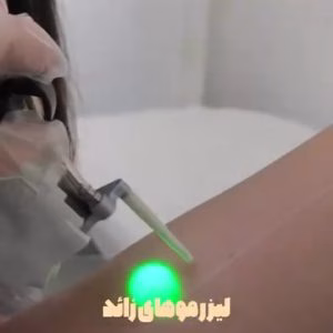 مرکز لیزر اکسیر، بهترین مرکز لیزر در تبریز
