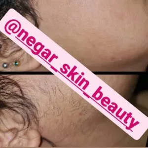 Negar waxing salon سالن اپیلاسیون نگار، بهترین سالن اپیلاسیون بدن در شیراز