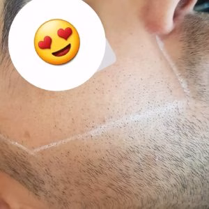 مرکز لیزر سخاوتمند، بهترین مرکز لیزر در تبریز