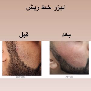 مرکز لیزر سخاوتمند، بهترین مرکز لیزر در تبریز