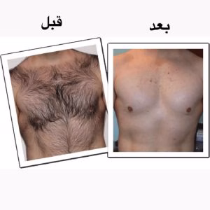 مرکز لیزر سخاوتمند، بهترین مرکز لیزر در تبریز