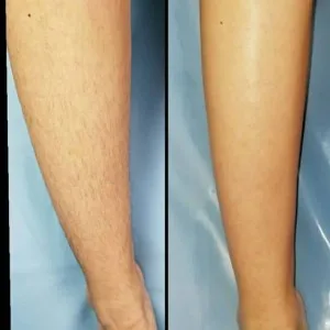 Shiraz waxing salon (3) سالن اپیلاسیون شیراز، بهترین سالن اپیلاسیون بدن در شیراز