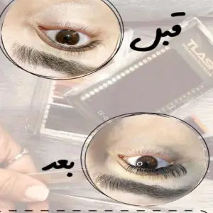 کاشت مژه هستی
