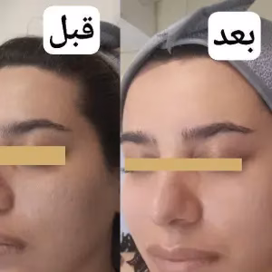 markz baran tos1 مرکز باران توس بهترین مرکز فشیال پوست در مشهد