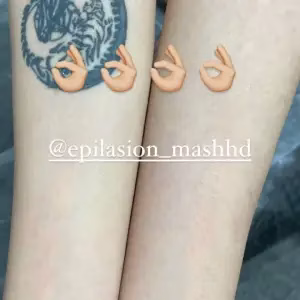 markz epilasion ramezani3 مرکز اپیلاسیون رمضانی بهترین مرکز اپیلاسیون در مشهد