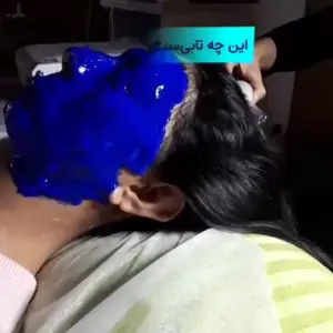markz fishial poost marzieh sadighi5 مرکز فیشیال پوست مرضیه صدیقی بهترین مرکز فیشیال پوست در اصفهان