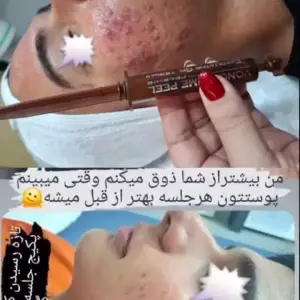 markz fishial poost mina porsid4 مرکز فیشیال پوست مینا پورسید بهترین مرکز فیشیال پوست در اصفهان