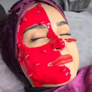 markz fishial poost sima zare2 مرکز فیشیال پوست سیما زارع بهترین مرکز فیشیال پوست در اصفهان