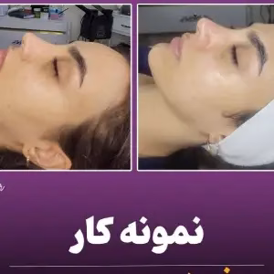 markz fishial poost sima zare3 مرکز فیشیال پوست سیما زارع بهترین مرکز فیشیال پوست در اصفهان