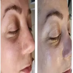 markz oksir javani5 مرکز اکسیر جوانی مرکز فشیال پوست مشهد
