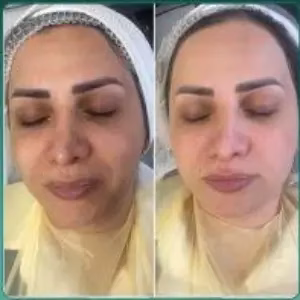 markz yas4 مرکز یاس مرکز فشیال پوست مشهد
