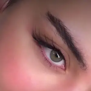 کاشت مژه نرجس