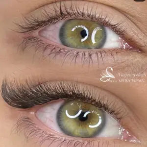 کاشت مژه نرجس