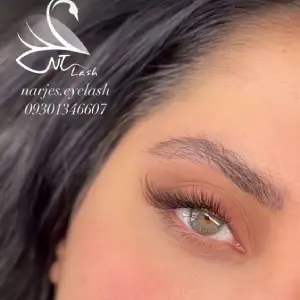 کاشت مژه نرجس