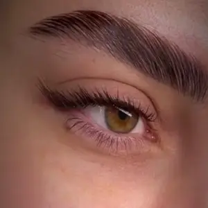 کاشت مژه نرجس
