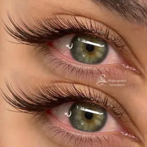 کاشت مژه نرجس