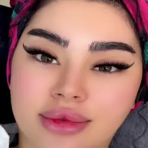کاشت مژه نگار