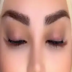 کاشت مژه نگار