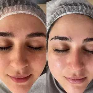 noavaran zibayi3 مرکز فشیال پوست مشهد