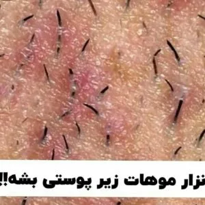 waxing salon mahsa (3) سالن اپیلاسیون مهسا، بهترین سالن اپیلاسیون بدن در شیراز
