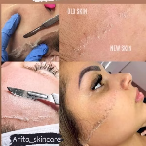 Arita facial center (4) مرکز فیشیال آریتا، بهترین مرکز فیشیال در تبریز