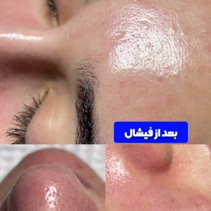 Aysu facial center (1) مرکز فیشیال آیسو، بهترین مرکز فیشیال در تبریز