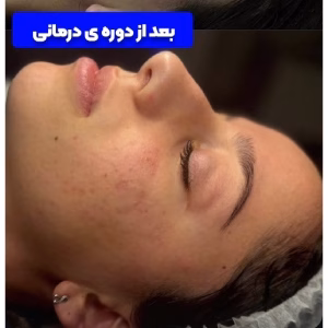 Aysu facial center مرکز فیشیال آیسو، بهترین مرکز فیشیال در تبریز