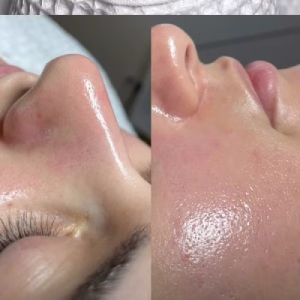 Aysu facial center (2) مرکز فیشیال آیسو، بهترین مرکز فیشیال در تبریز