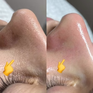 Aysu facial center (4) مرکز فیشیال آیسو، بهترین مرکز فیشیال در تبریز