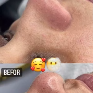 Neda facial center (1) مرکز فیشیال ندا، بهترین مرکز فیشیال در تبریز