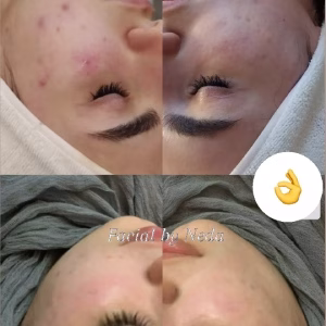 Neda facial center (2) مرکز فیشیال ندا، بهترین مرکز فیشیال در تبریز