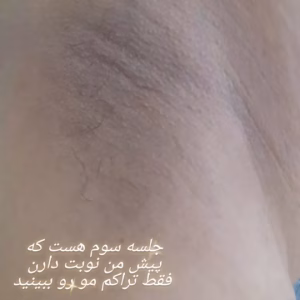 سالن اپیلاسیون سمیرا داوری، بهترین سالن اپیلاسیون در اصفهان