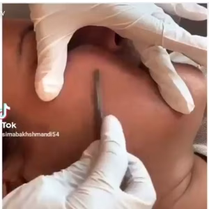 Tabriz facial center (2) مرکز فیشیال تبریز، بهترین مرکز فیشیال در تبریز