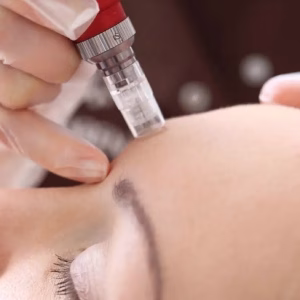 Tabriz facial center (3) مرکز فیشیال تبریز، بهترین مرکز فیشیال در تبریز