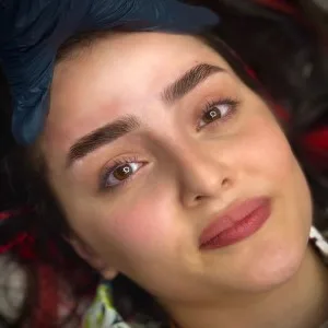 Shadi Habibi Eyebrow Fibrosis Salon.3